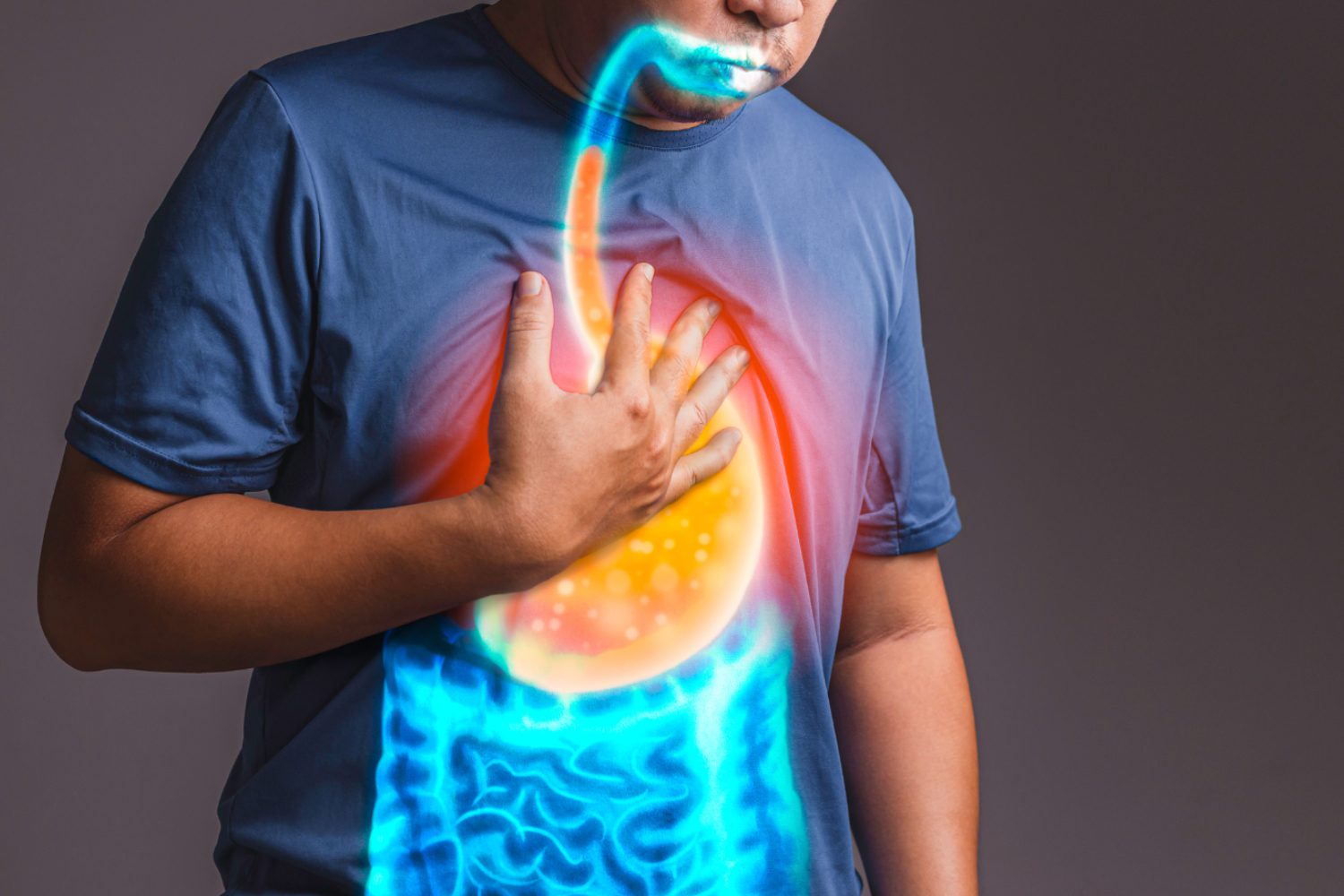 acid reflux NYMVC acid reflux NYMVC